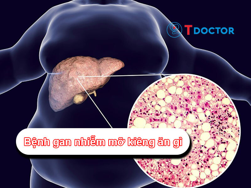 Tìm hiểu bệnh gan nhiễm mỡ nên ăn gì và không nên ăn gì? Tìm hiểu bệnh gan nhiễm mỡ nên ăn gì và không nên ăn gì?