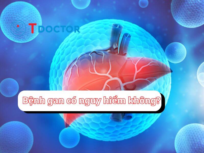 Bệnh gan có nguy hiểm không và những điều cần biết. Bệnh gan có nguy hiểm không và những điều cần biết.