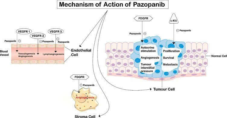 Hy vọng mới trong điều trị ung thư thận và Sarcoma mô mềm tiến triển Hy vọng mới trong điều trị ung thư thận và Sarcoma mô mềm tiến triển