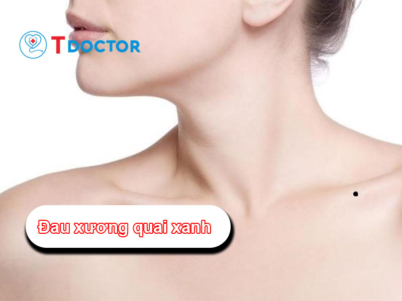Đau xương quai xanh là bệnh gì? Nguyên nhân và cách điều trị