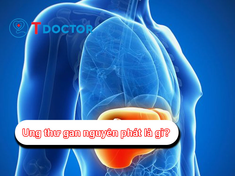 Ung thư gan nguyên phát là gì? Nguyên nhân và điều trị
