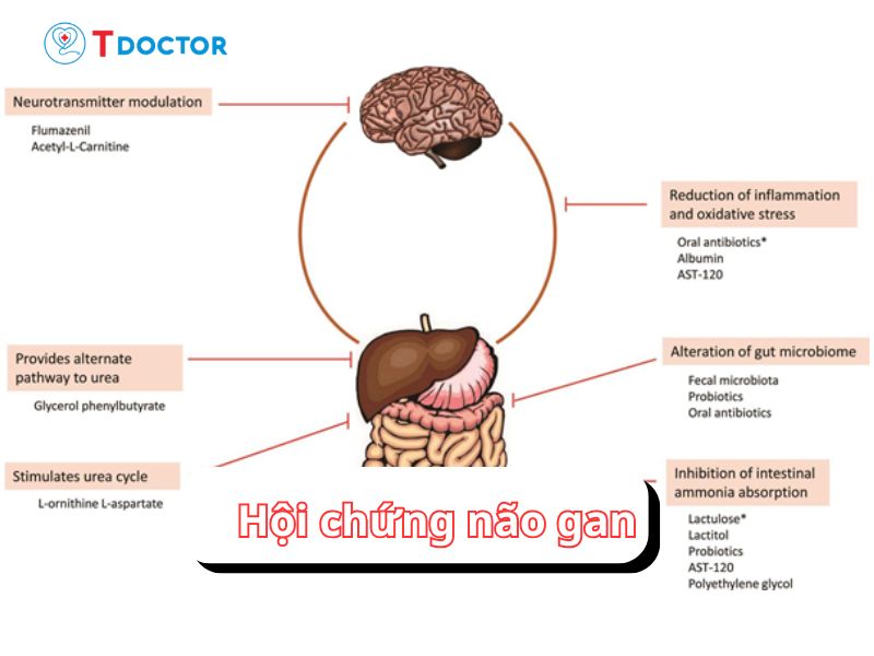 Hội chứng não gan những điều nhất định bạn phải biết
