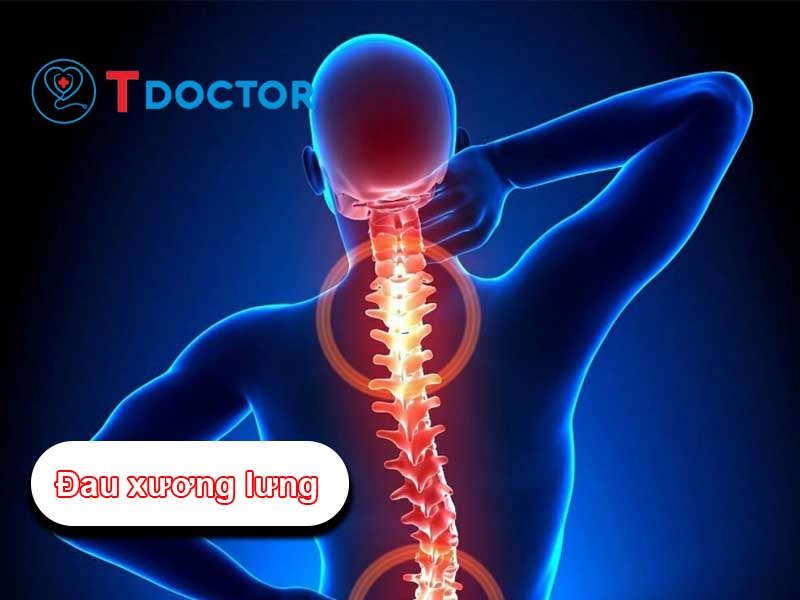 Nguyên nhân và điều trị bệnh đau xương lưng hiệu quả