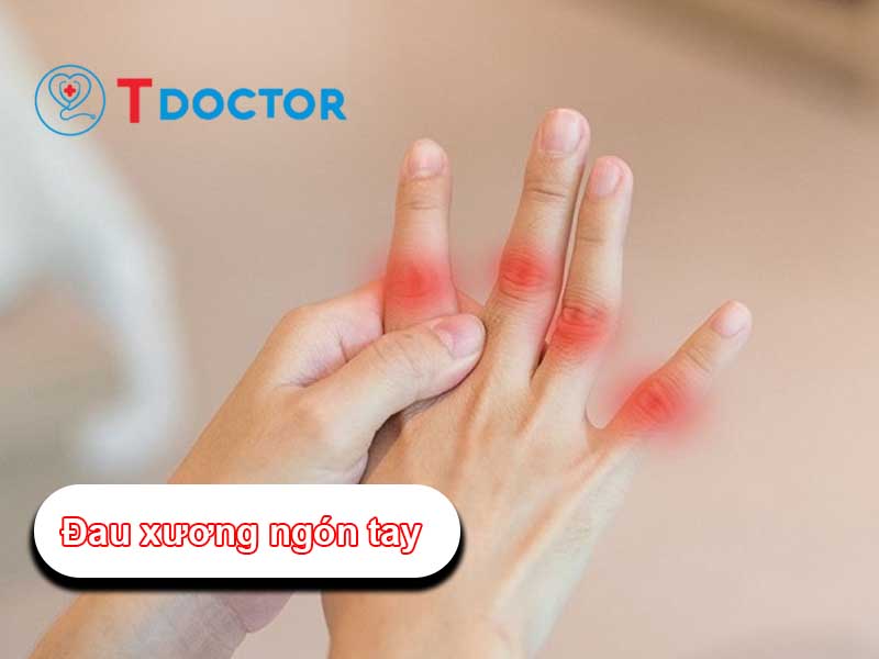 Đau xương ngón tay: Nguyên nhân và cách điều trị hiệu quả