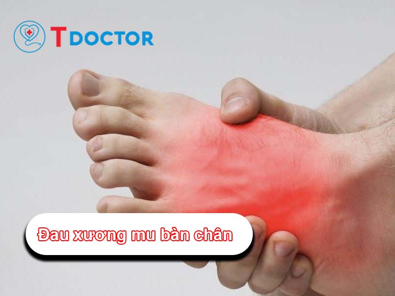 Đau xương mu bàn chân: Nguyên nhân, dấu hiệu và điều trị